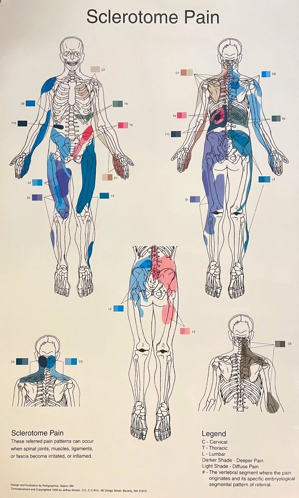 Back & Neck Pain 1