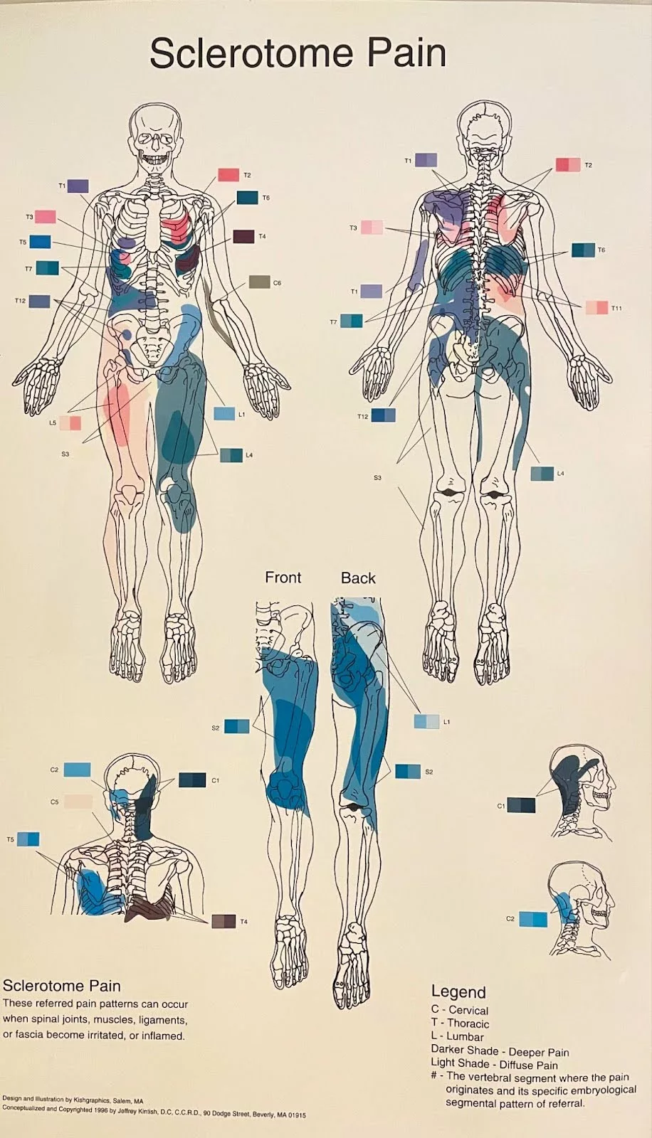 Back & Neck Pain 2